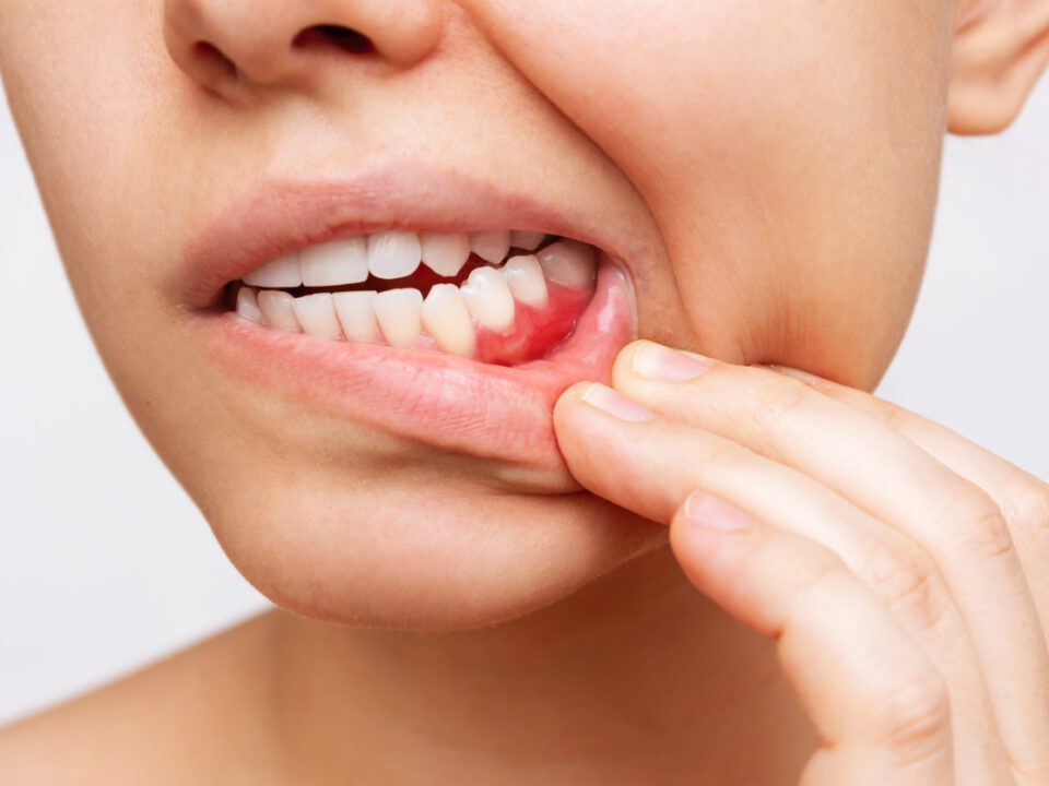 Learn how to recognize signs of tooth infection and when to seek treatment.