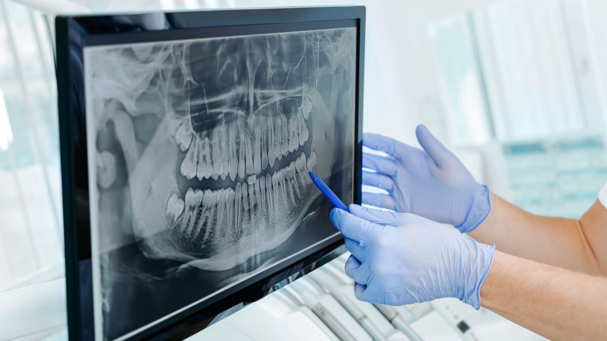 Learn about dental X-rays on our family dentistry practice’s blog.